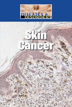 Skin cancer  Cover Image